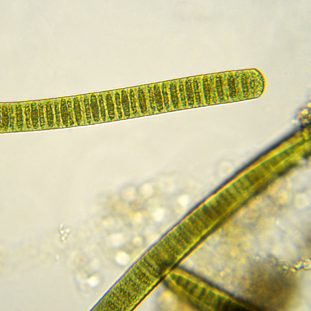 Cyanobacteria Reef Tank Microscope
